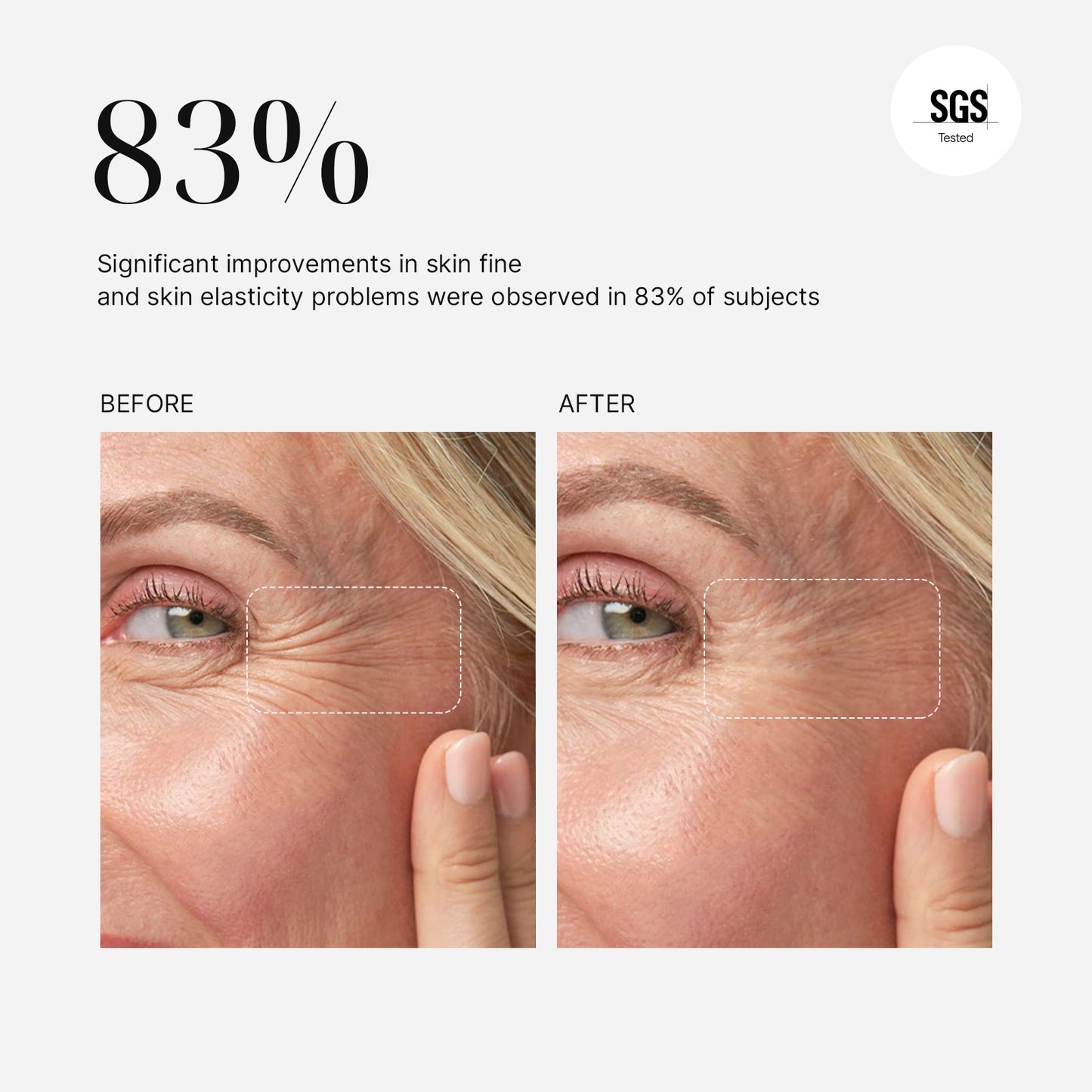Mimisilk Nova 830nm Laser, 83% significant improvements in skin fine