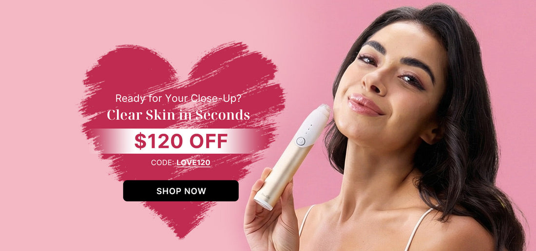 The Home Acne Battle: High-Frequency Wands vs. Laser Light – Why the Mimisilk Nova Represents a New Frontier