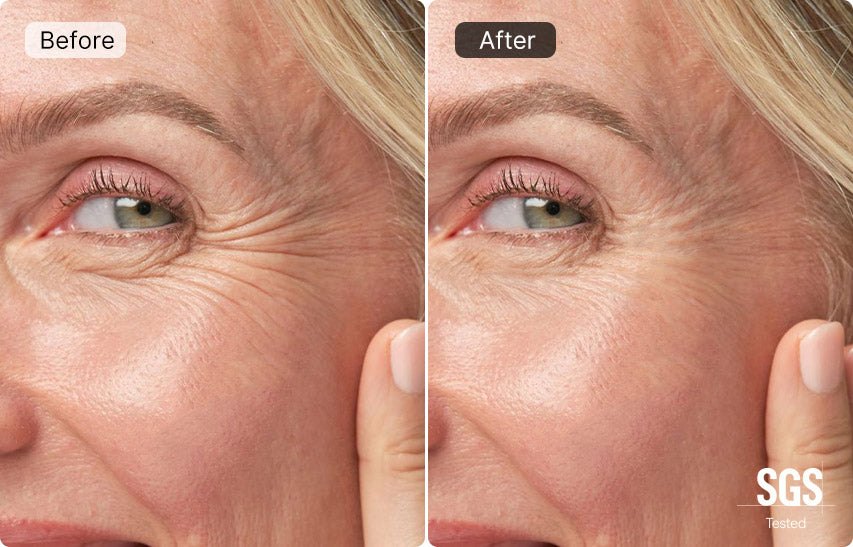 The Ultimate Guide to Erasing Fine Lines and Restoring Youthful Skin