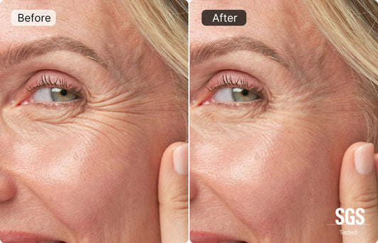 The Ultimate Guide to Erasing Fine Lines and Restoring Youthful Skin