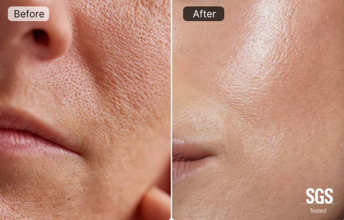 The Definitive Guide to Minimizing Pores: Science, Solutions, and Realistic Expectations