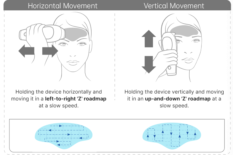25 Most Frequently Asked Questions of Iris 1450nm - Which one do you care about the most?