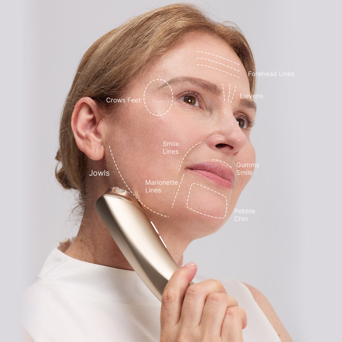 MimiSilk Vera RF Sculpt™ | 6.25MHz RF Skin Tightening Device