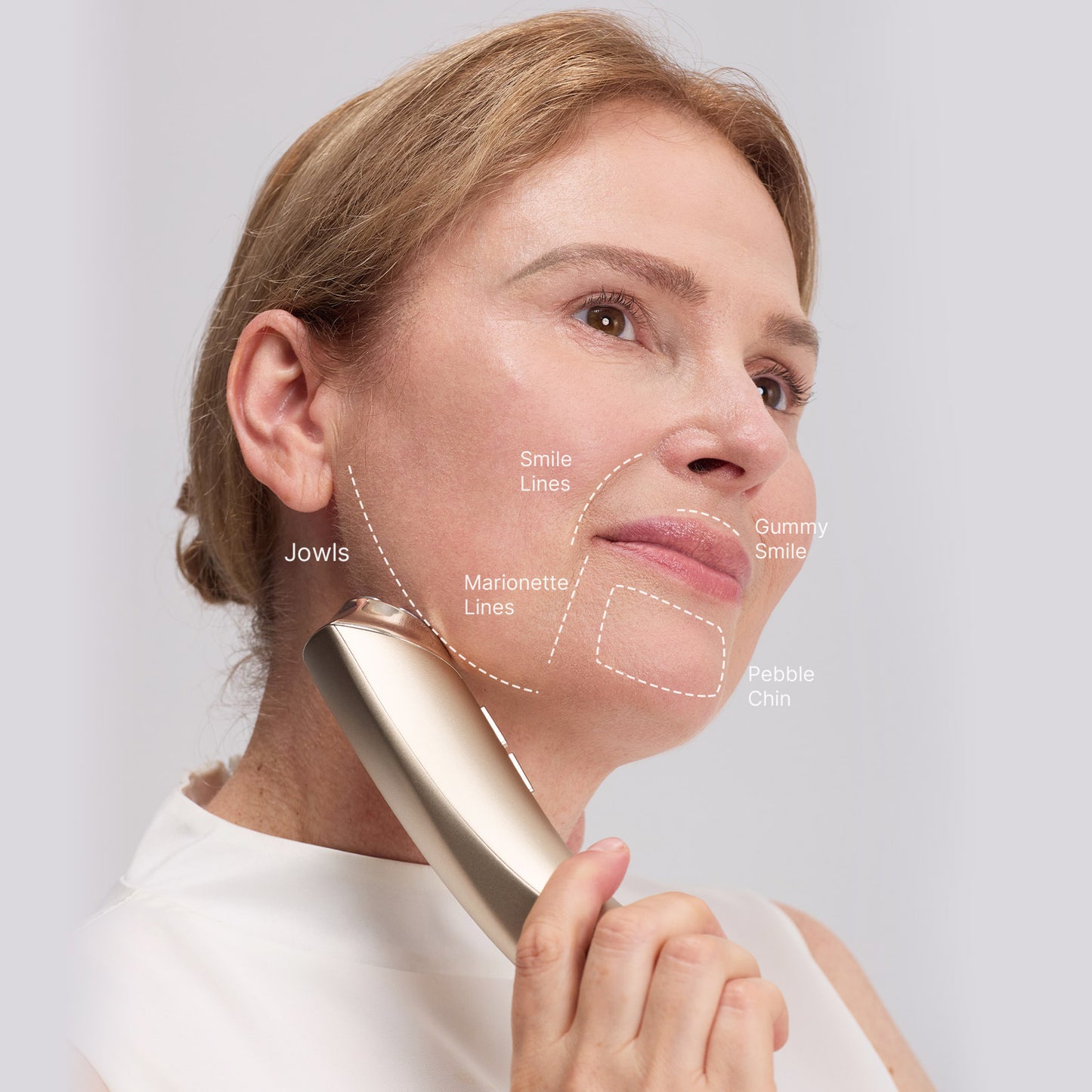 MimiSilk Vera RF Sculpt | 6.25MHz Gel-Free Radio Frequency Skin Lifting Device