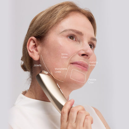 MimiSilk Vera RF Sculpt | 6.25MHz Gel-Free Radio Frequency Skin Lifting Device