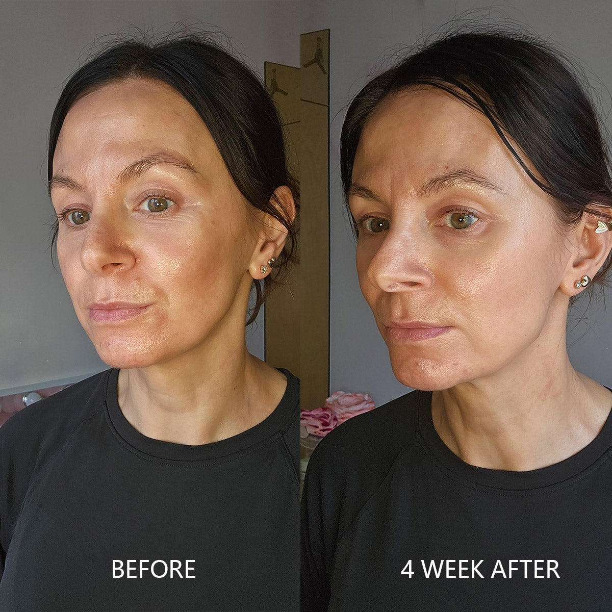 Pore & Texture Refining, Before and after comparison of a woman's face with 4 Week After.