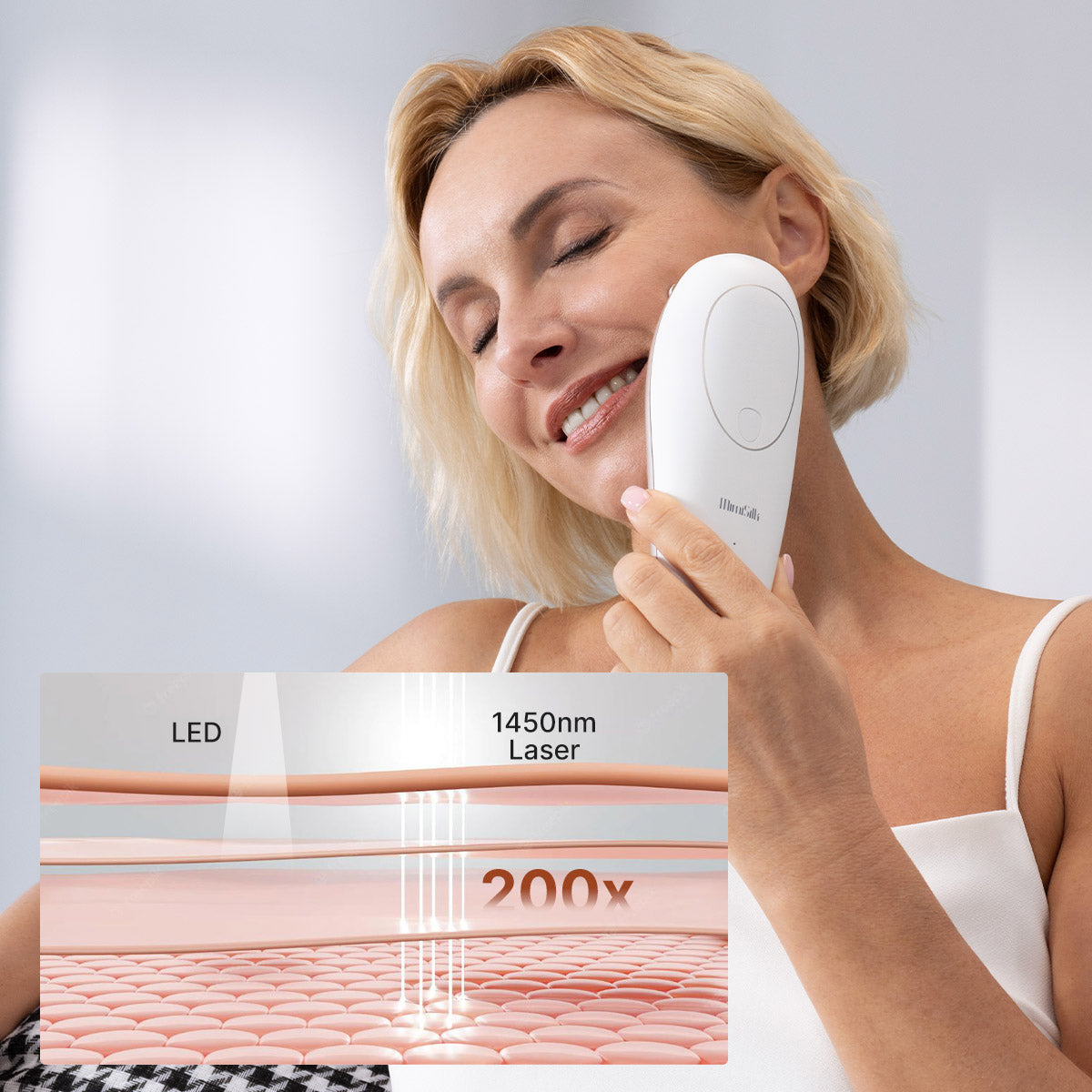 Mimisilk Iris 1450nm Laser