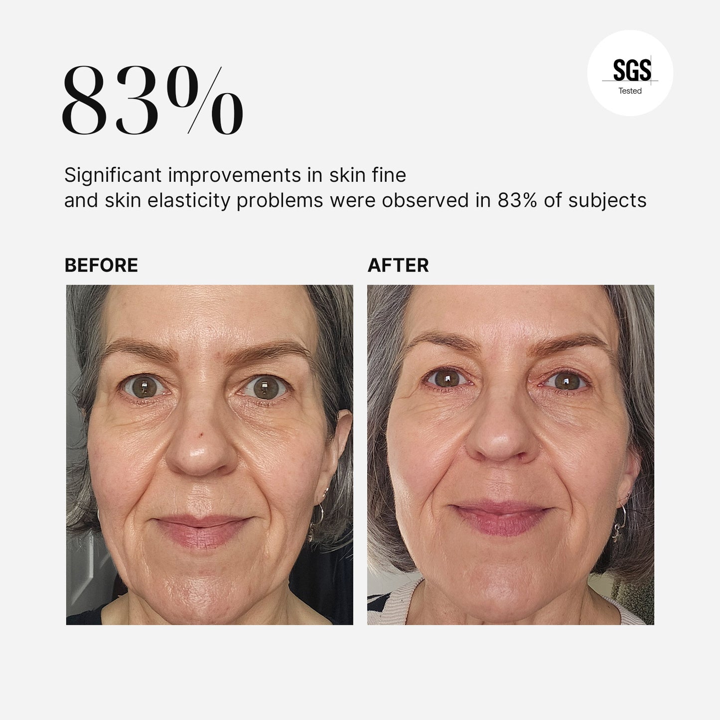 MimiSilk Iris | 1450nm Advanced At-Home Fractional Laser Device for Anti-Aging