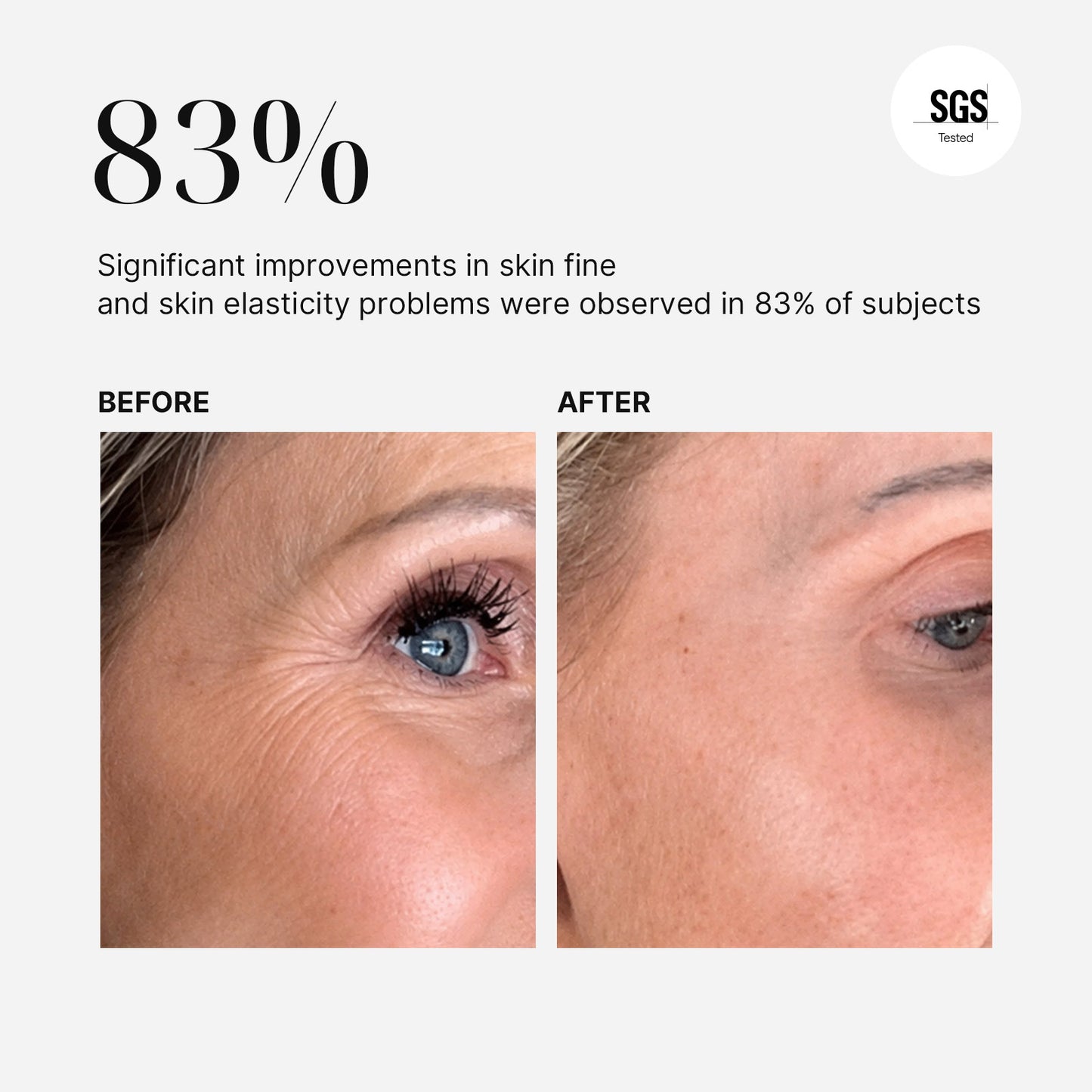 Before-and-after comparison of a woman's eye area showing wrinkles, with text stating '83% Significant improvements in skin fine and skin elasticity problems were observed in 83% of subjects' and an SGS Tested badge.