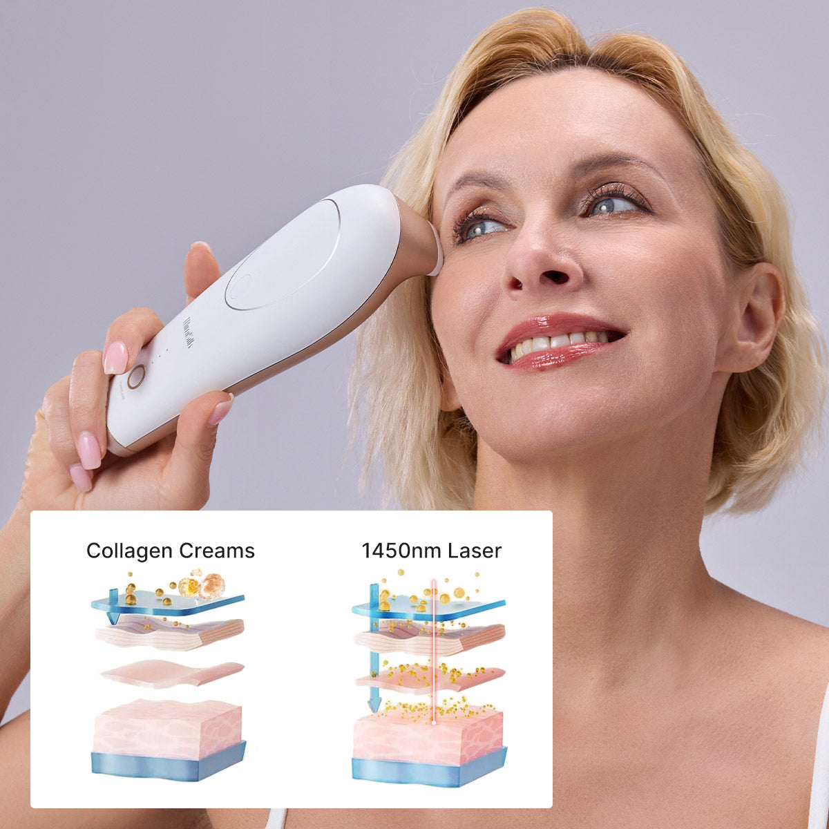 Mimisilk Iris 1450nm laser