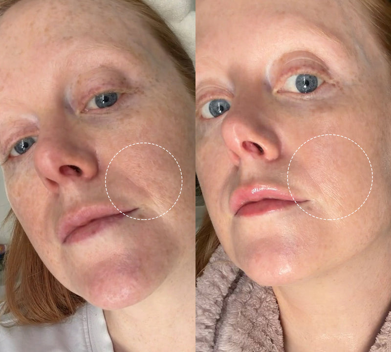 I didn't expect such improvement in four weeks-my skin's smoother, brighter, and pigmentation's better. Truly incredible! I'm 38.
