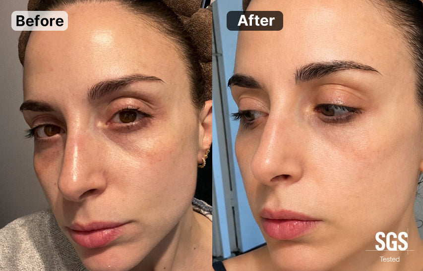 A side-by-side before and after facial comparison of a woman's face, showing skin improvement. The left side is labeled 'Before' and shows darker, less even skin; the right side is labeled 'After' and shows brighter, smoother skin.