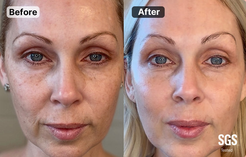 Before and after close-up facial comparison of a woman's face, showing skin texture and appearance improvement. The left side is labeled 'Before' and the right side is labeled 'After', with an 'SGS Tested' mark in the bottom right corner.