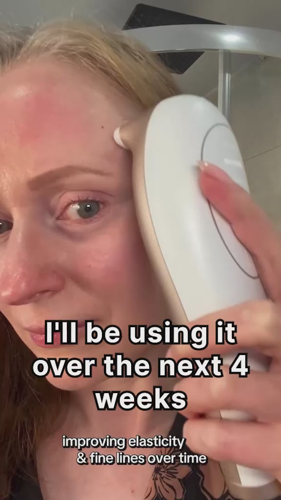 Mimisilk iris 1450nm using it over the next 4 weeks