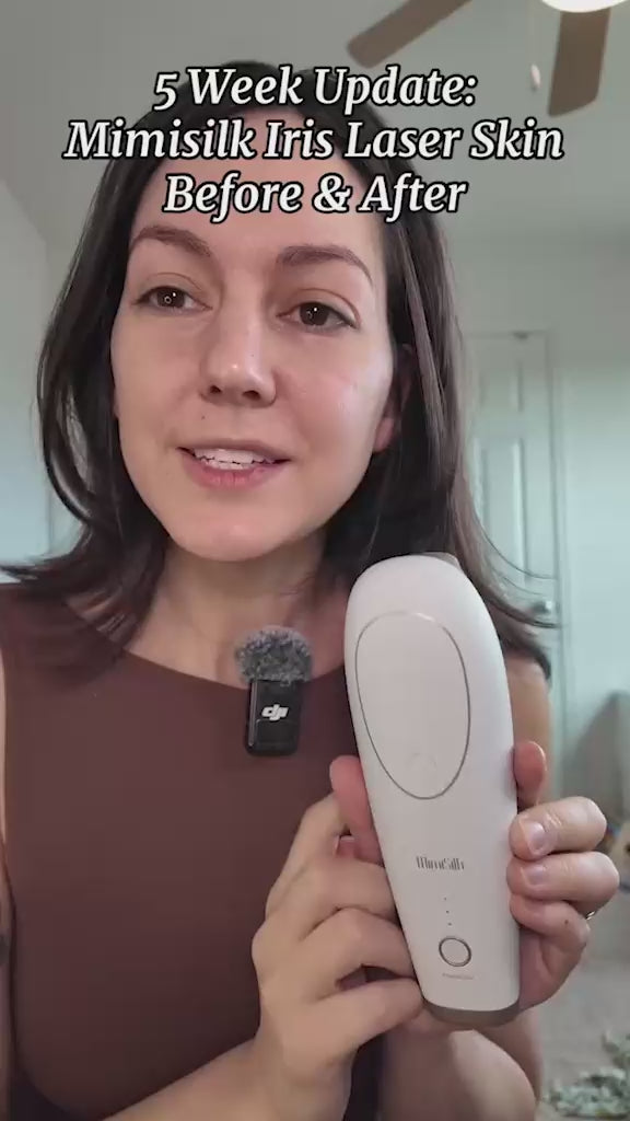 Mimisilk iris laser skin, 5 weeks after for pores