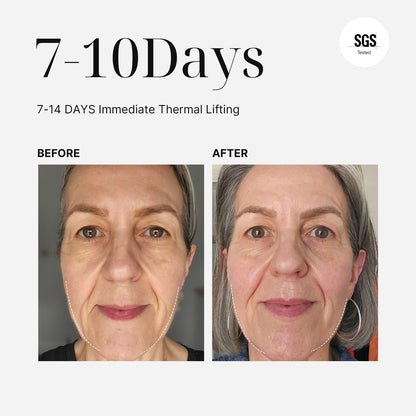 MimiSilk Vera RF Sculpt | 6.25MHz Gel-Free Radio Frequency Skin Lifting Device